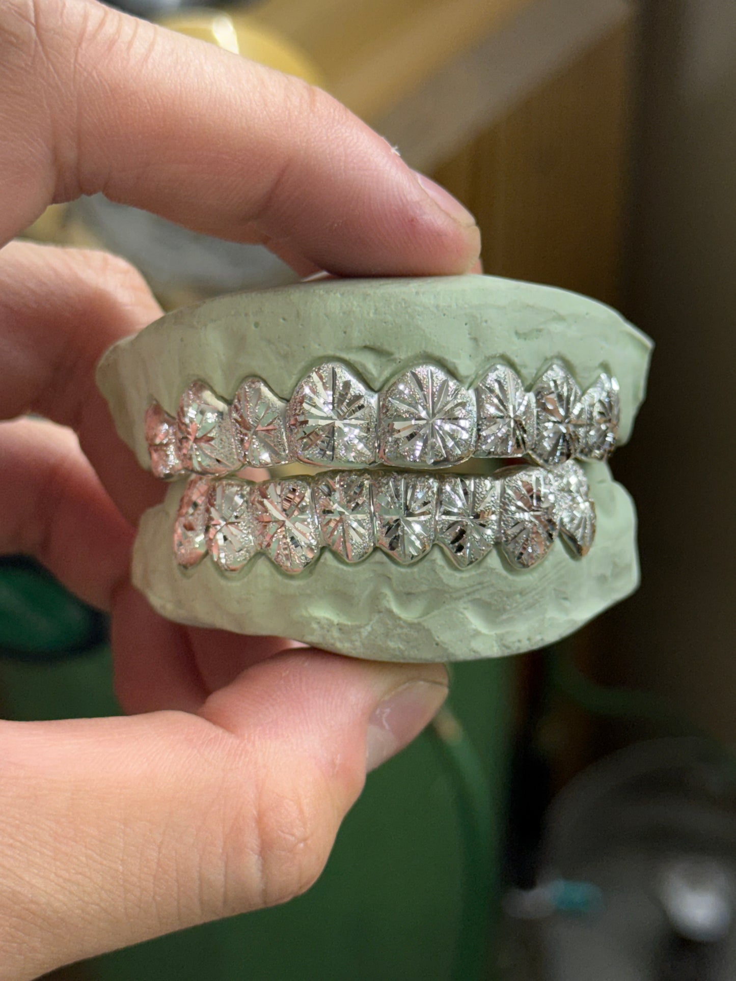 Star Burst Grillz with Diamond Dust