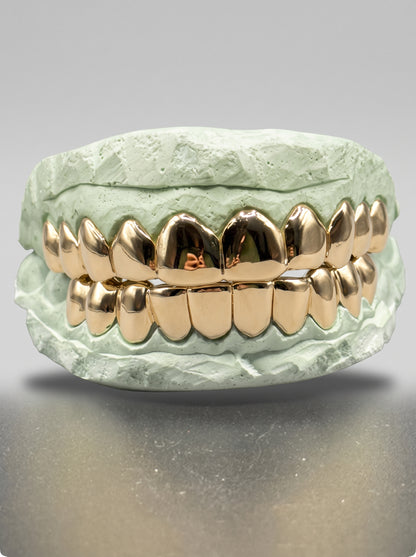 Custom Solid Gold Grillz